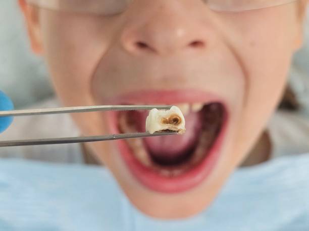 Best Emergency Pediatric Dental Care in Lampasas, TX